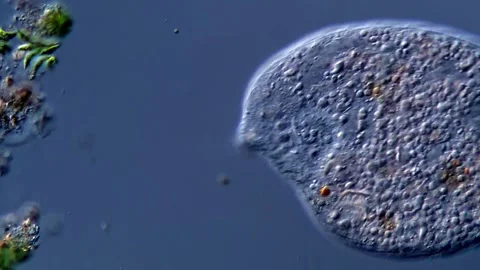 Ciliate under microscopy view 库存影片 310315702