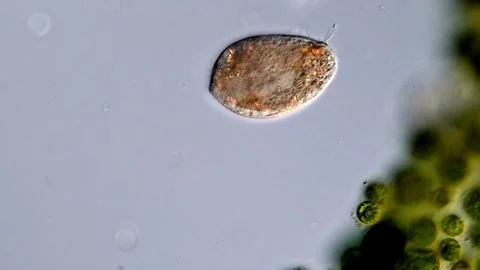 Ciliate under microscopy view 库存影片 310640464
