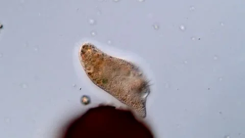 Ciliate under microscopy view 库存影片 310640748