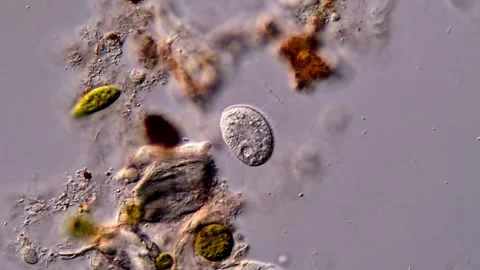 Ciliate under microscopy view 库存影片 310641920