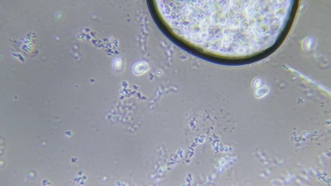Ciliate under Phase contrast Microscope Video stock 80387484