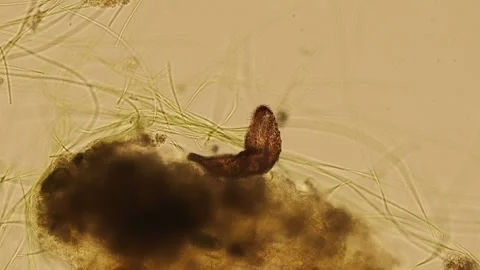 Ciliated flatworm Turbellaria under the microscope Stock Footage 232471560
