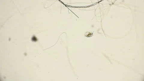 Ciliated infusoria in motion under a mic... | Stock Video | Pond5