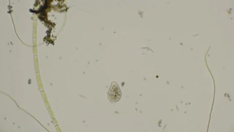 Ciliated infusoria under a microscope Stock Footage 89567802
