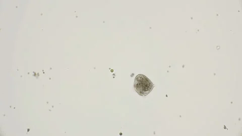 Ciliated infusorians under a microscope Stock Footage 89570345