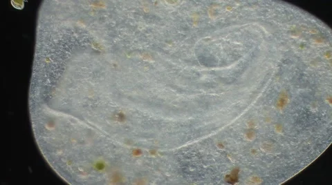 Ciliated Protozoa 스톡 동영상 64802424