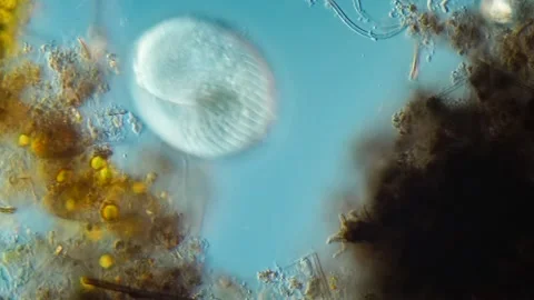Ciliated protozoa searching in substrate under DIC microscopy, 40x lens Stock Footage 315924281