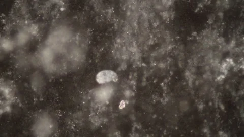 Ciliates in drops of water Stock Footage 338117148