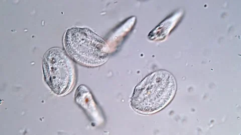 Ciliates, euglena under microscopy view 库存影片 310640673