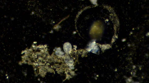 Ciliates Stockbeeldmateriaal 64826611