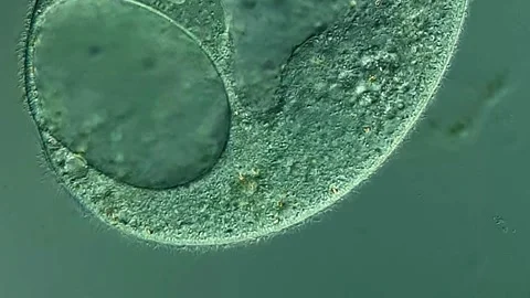 Ciliates protozoa under microscopic view 400x 库存影片 306587872
