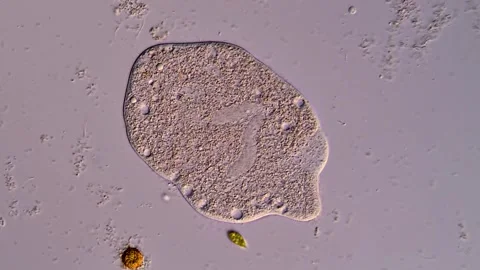 Ciliates protozoa under microscopy Vidéo 310644783