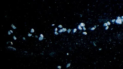 Ciliates under microscope dark field Stock Footage 293610916