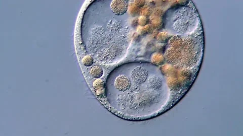 Ciliates under microscope, protozoa microorganism movement 400x 库存影片 317108033