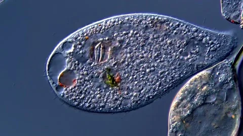 Ciliates under microscope view 400x 库存影片 310314184