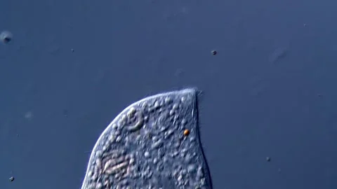 Ciliates under microscope view 400x 库存影片 310315698