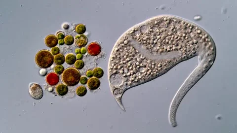 Ciliophora and algae under microscopy view 스톡 동영상 310379206