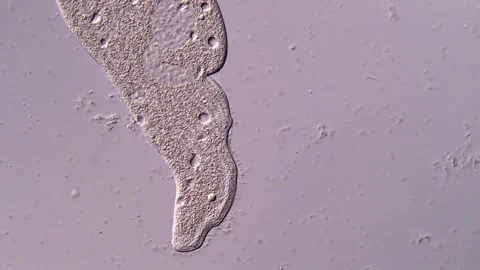 Ciliophora Ciliate under microscope 库存影片 310643022