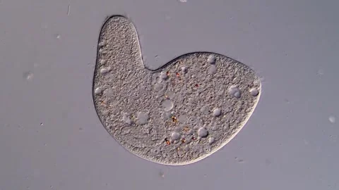 Ciliophora Ciliate under microscope 库存影片 310645997