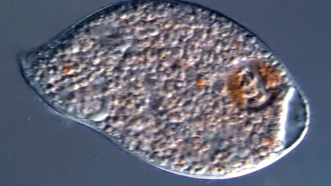 Ciliophora Ciliate under microscopy view 库存影片 310648243
