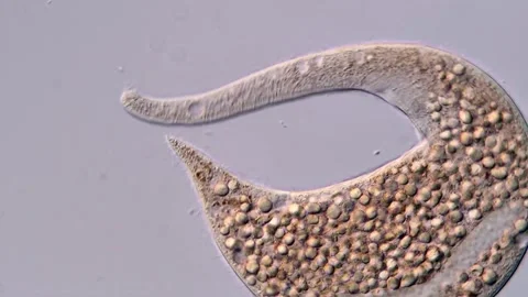 Ciliophora: Dileptus Ciliate under microscopy view Vidéo 310495997