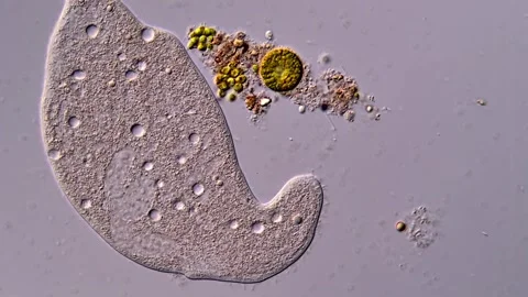 Ciliophora Dileptus 스톡 동영상 310642903