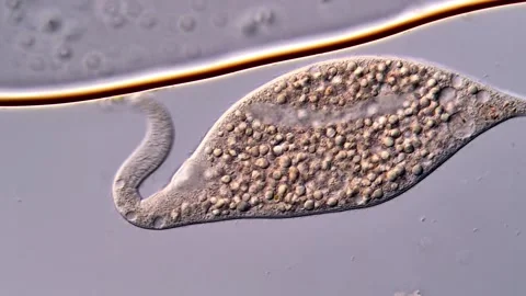 Ciliophora dileptus under DIC microscope view 库存影片 310355659