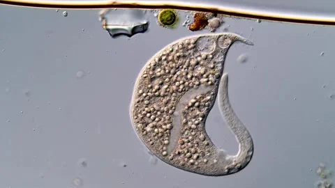 Ciliophora dileptus under DIC microscope view 库存影片 310357608