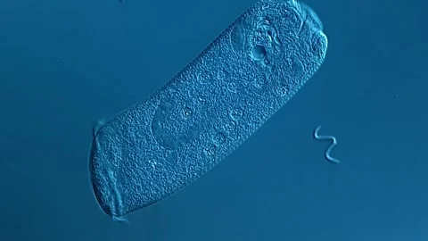 Ciliophora protozoa under microscopy view 库存影片 306590884