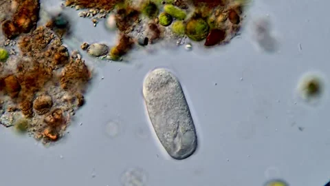 Ciliophora protozoa under microscopy view 库存影片 310386451