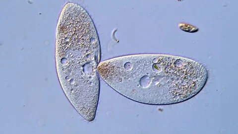 Ciliophora protozoa under microscopy view, 4K Video 库存影片 318001983
