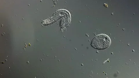 Ciliophora under microscope view 400x magnification 库存影片 306578692