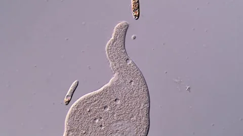 Ciliophora under microscope view 400x magnification Vídeos de archivo 310491743