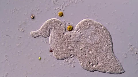 Ciliophora under microscope view 400x magnification 库存影片 310500763