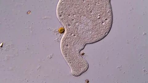 Ciliophora under microscope view 400x magnification 库存影片 310500927