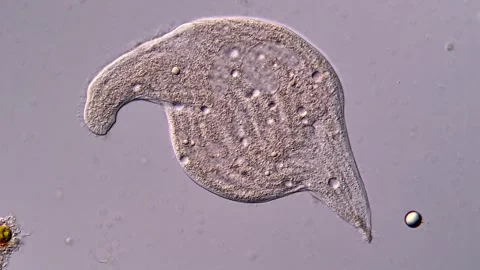 Ciliophora under microscope view 400x magnification 스톡 동영상 310642402
