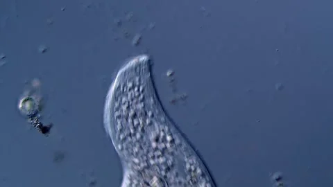 Ciliophora under microscope view 库存影片 310315462