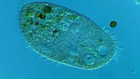 Ciliophora under microscopy view, 400x magnification 库存影片 306590192
