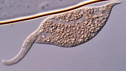 Ciliophora under microscopy view, 400x magnification 库存影片 310356222
