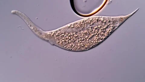 Ciliophora under microscopy view, 400x magnification 库存影片 310384322