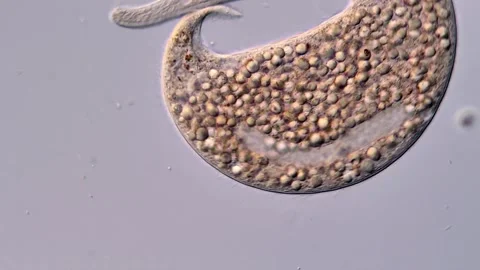 Ciliophora under microscopy view, DIC microscope 400x 스톡 동영상 310497176