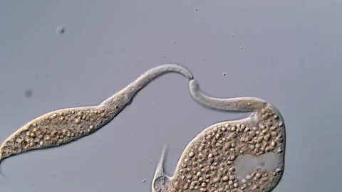 Ciliophora under microscopy view, pond water sample 库存影片 310304262
