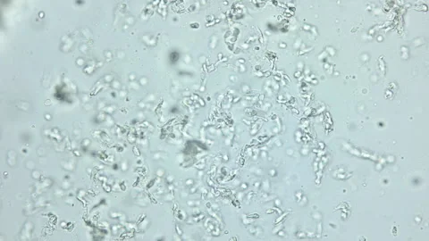Ciliophoras Licnophora sp. under microscope, class Spirotrichea. Stock Footage 340770847