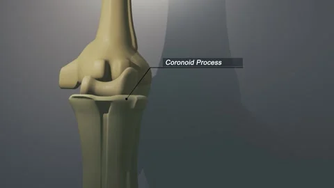 Cinematic Elbow Bone - Coronoid Process Stock Footage 310671631