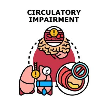 Circulatory impairment causing health problems vector concept Stock Illustration