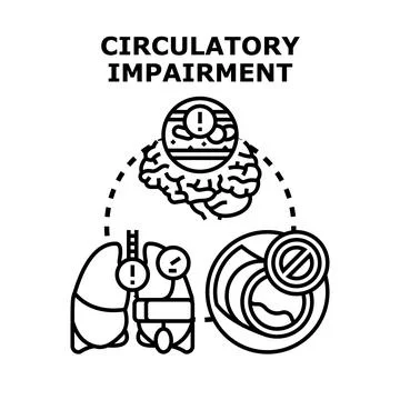 Circulatory impairment causing health problems vector concept Stock Illustration