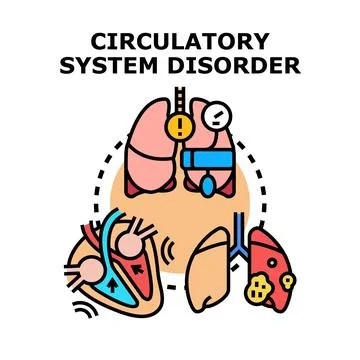 Circulatory system disorder concept with human organs Stock Illustration