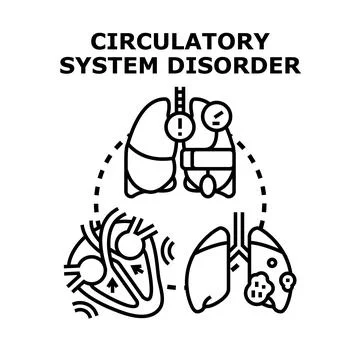 Circulatory system disorder concept with human organs Stock Illustration