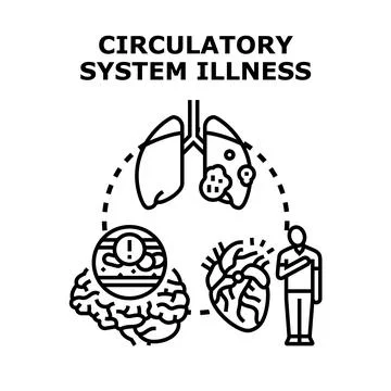 Circulatory system illness causing heart and brain disease Stock Illustration