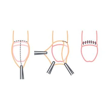 Circumcision line icon, vector illustration Stock Illustration